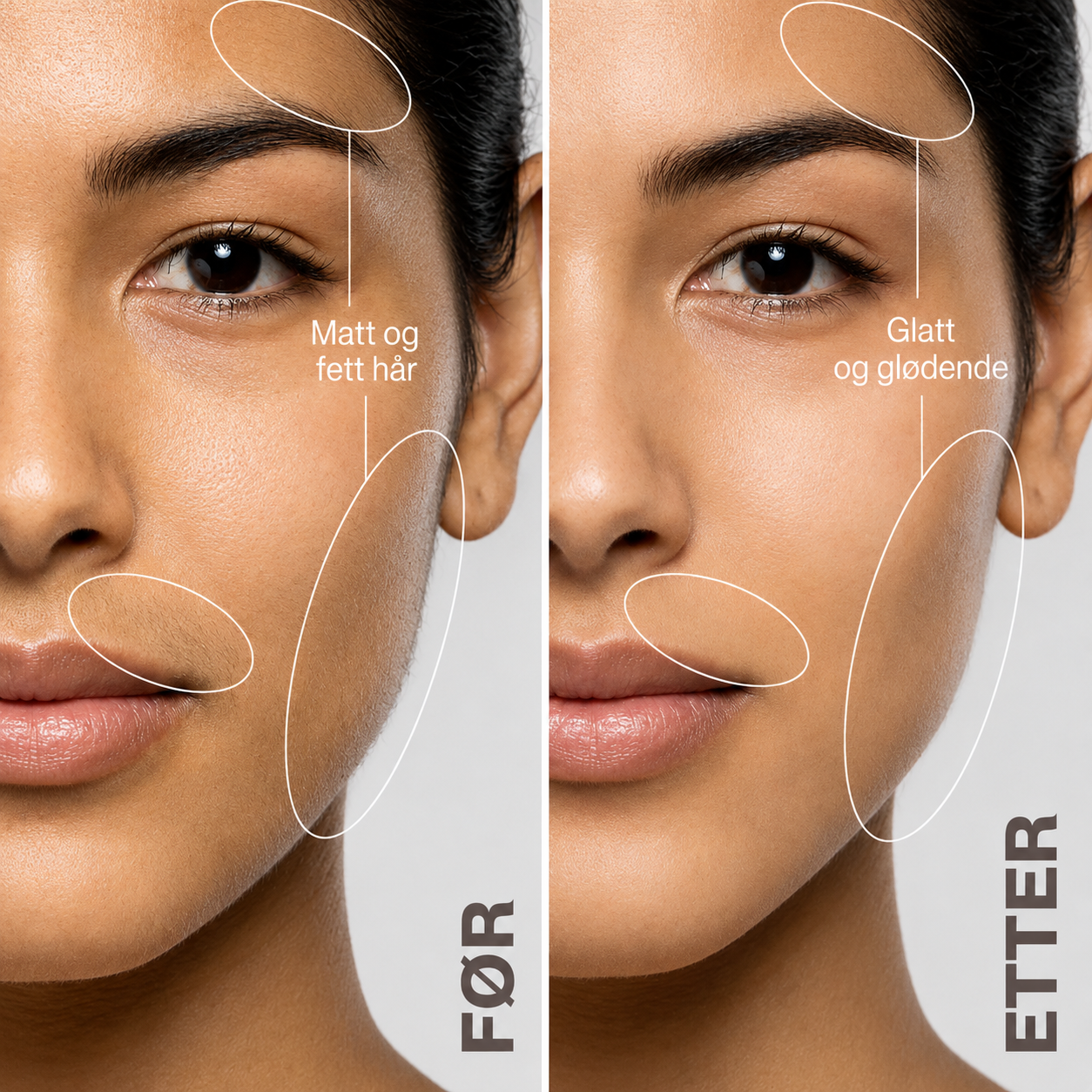 Elvian Dermaplaner